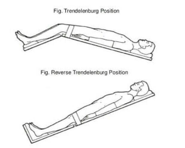 Patient Positioning Trendelenburg And Reverse Trendelenburg